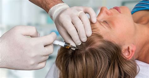 Wat Is Een Haartransplantatie En Hoe Werkt Het?